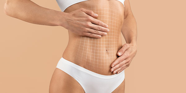 Abdominoplasty (Tummy Tuck)
