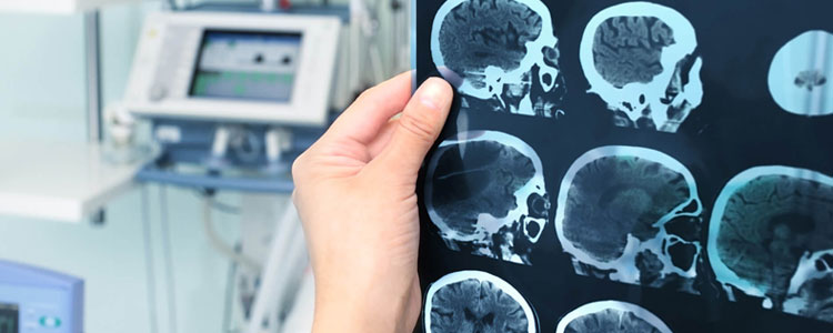 Neurosurgeon in Siliguri